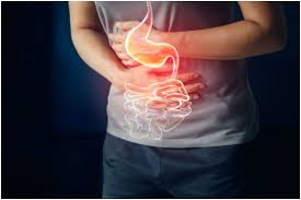 Supplements for Gastric Ulcers